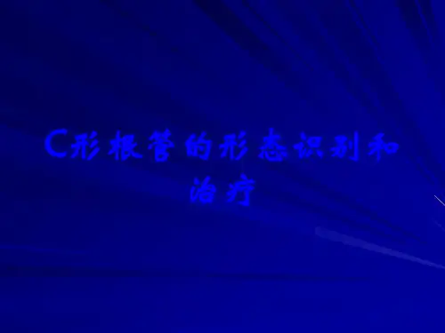 C形根管的形态识别和治疗