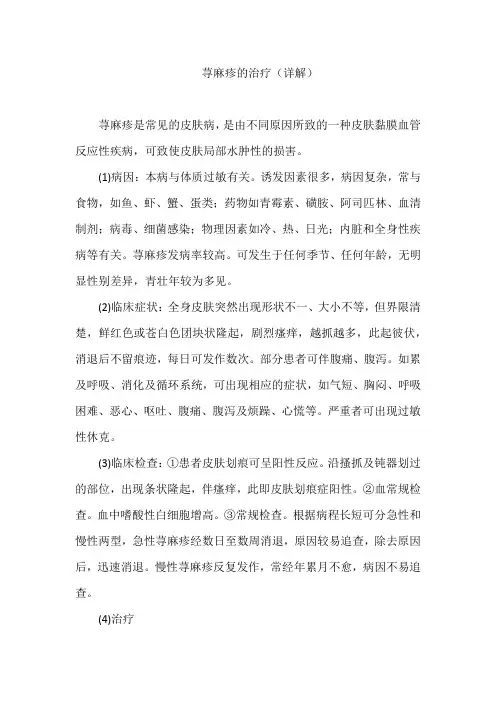 荨麻疹的治疗(详解)