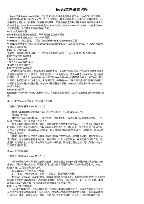 hosts文件设置攻略
