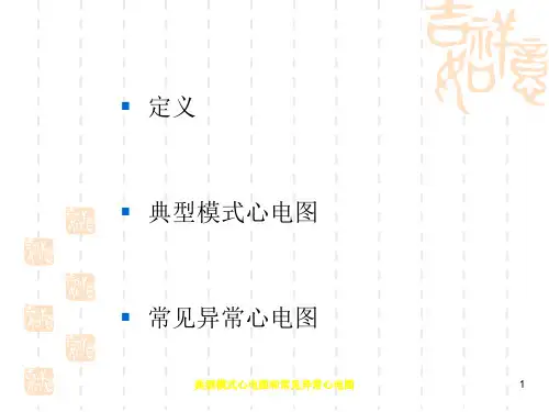 典型模式心电图和常见异常心电图培训课件