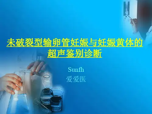 输卵管妊娠与妊娠黄体的超声鉴别诊断