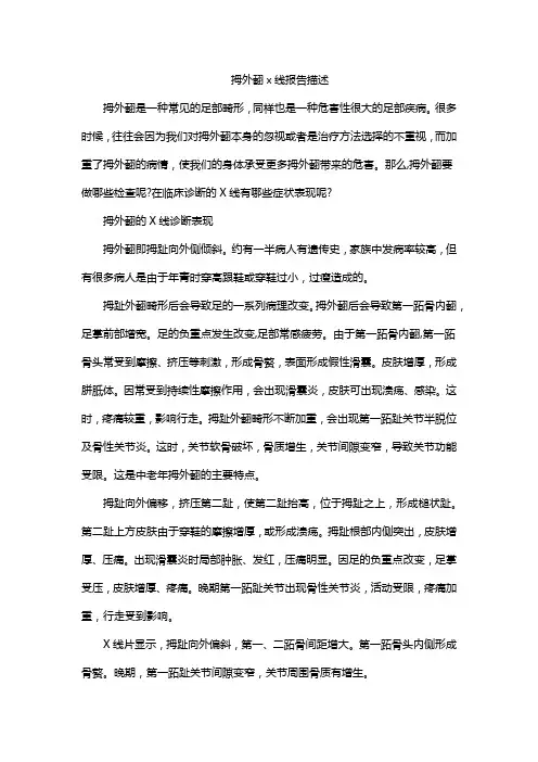 拇外翻x线报告描述