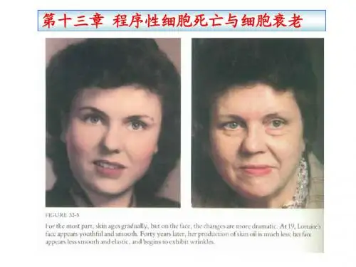 第十三章 程序性细胞死亡与细胞衰老