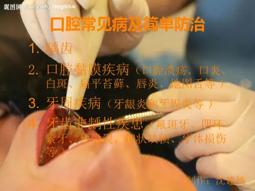 口腔常见疾病ppt课件