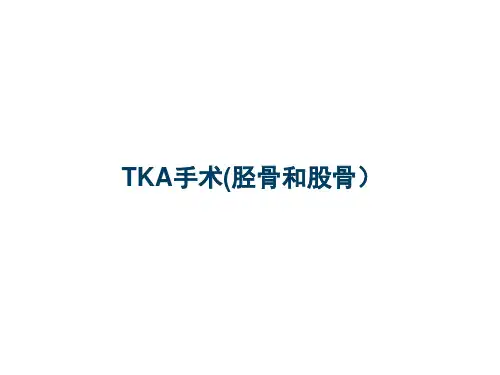 TKA手术(胫骨和股骨)