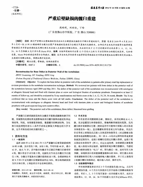严重后壁缺损的髋臼重建