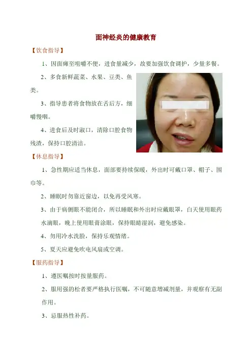 面瘫的健康教育