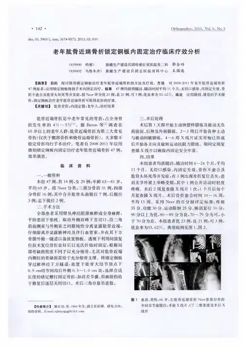 老年肱骨近端骨折锁定钢板内固定治疗临床疗效分析