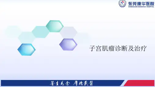 子宫肌瘤诊断及治疗