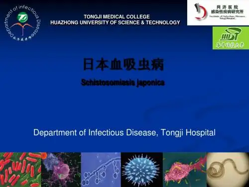 日本血吸虫病--同济医院感染科
