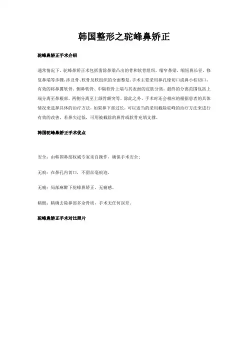 韩国整形之驼峰鼻矫正