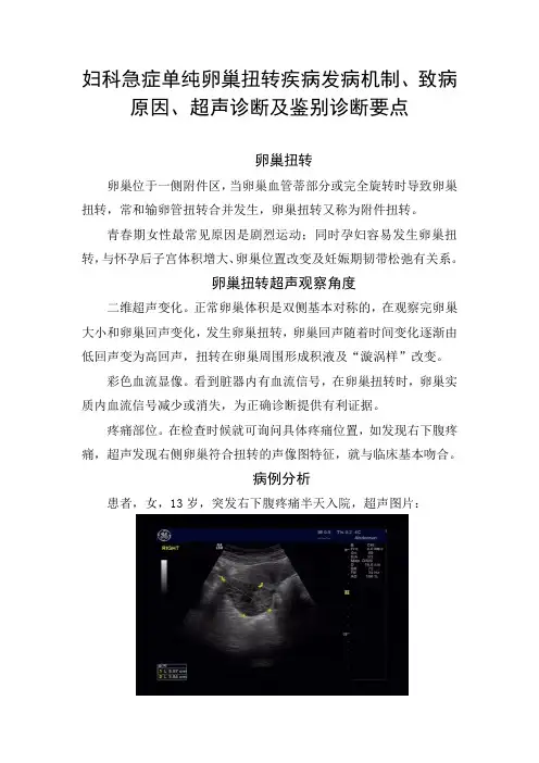 妇科急症单纯卵巢扭转疾病发病机制、致病原因、超声诊断及鉴别诊断要点
