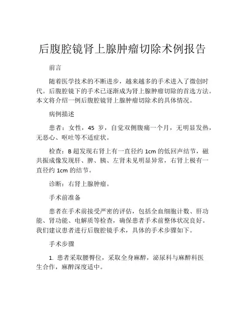 后腹腔镜肾上腺肿瘤切除术例报告