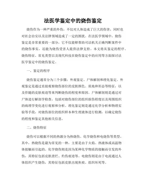法医学鉴定中的烧伤鉴定