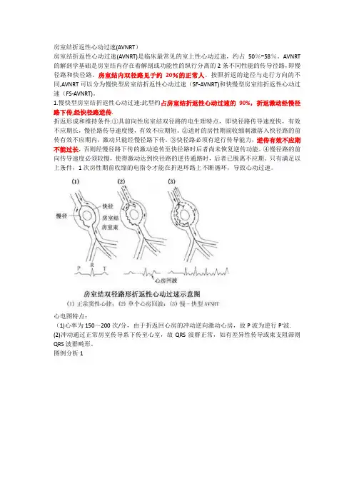 房室结折返性心动过速