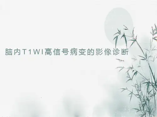 脑内T1WI高信号病变的影像诊断