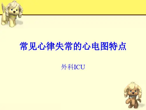 --常见心律失常的心电图特点PPT课件