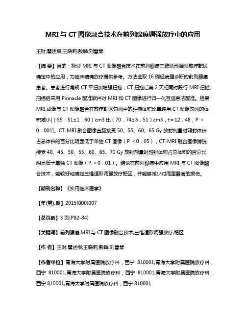 MRI与CT图像融合技术在前列腺癌调强放疗中的应用