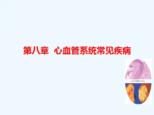 第八章心血管系统常见疾病