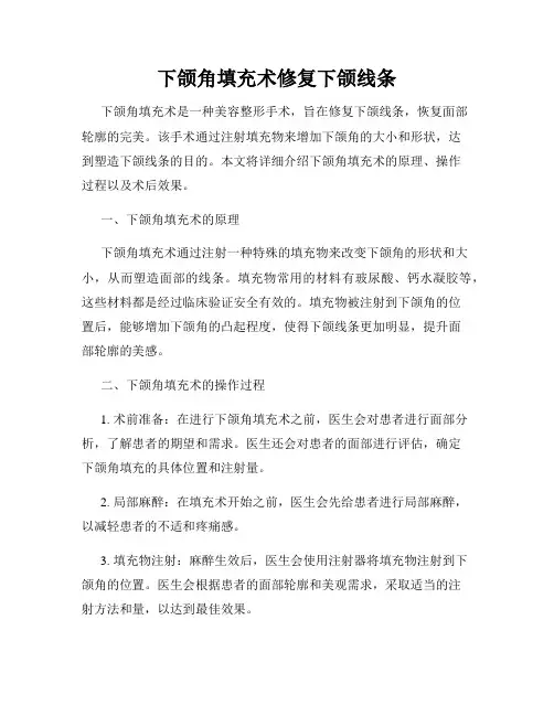 下颌角填充术修复下颌线条