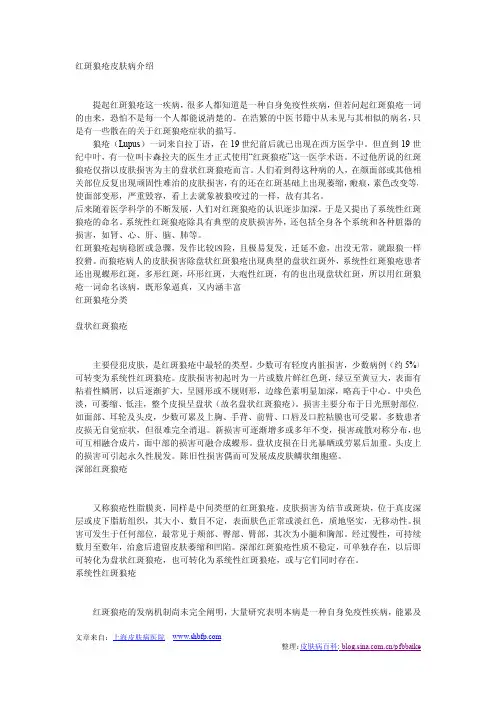 红斑狼疮皮肤病介绍