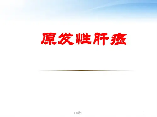 原发性肝癌  ppt课件