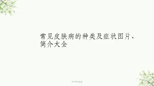 常见皮肤病的种类及症状图片、简介大全课件