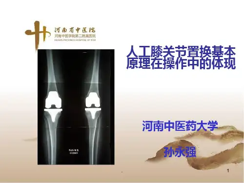 人工膝关节置换基本原理在操作中的体现PPT课件