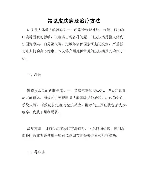 常见皮肤病及治疗方法