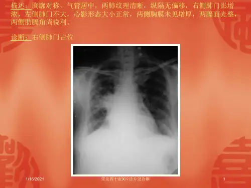 常见四十张X片读片及诊断培训课件