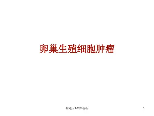 卵巢生殖细胞肿瘤PPT课件