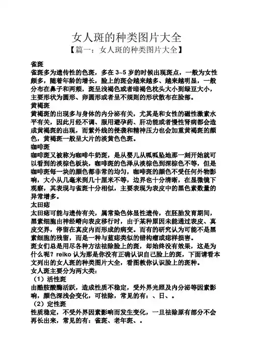 女人斑的种类图片大全
