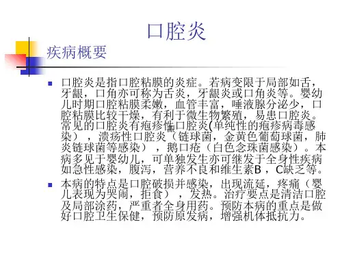 口腔炎介绍(ppt演示文稿)