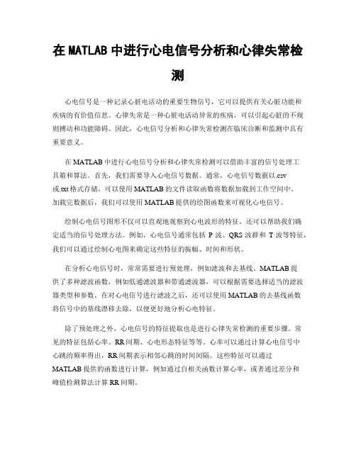 在MATLAB中进行心电信号分析和心律失常检测