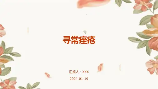 寻常痤疮演示ppt课件