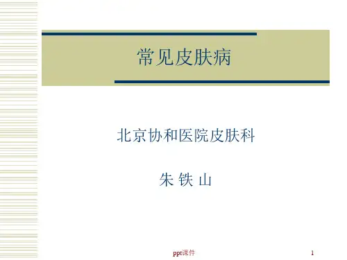 常见皮肤病(皮肤科)  ppt课件