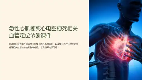 急性心肌梗死心电图梗死相关血管定位诊断课件