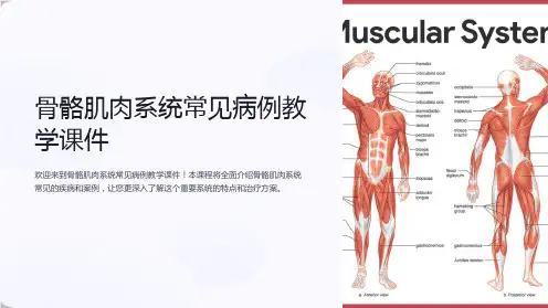 《骨骼肌肉系统常见病例教学课件》