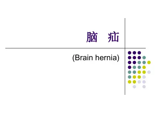 脑疝