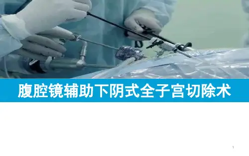 腹腔镜辅助阴式全子宫切除术