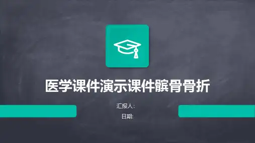 医学课件演示课件髌骨骨折