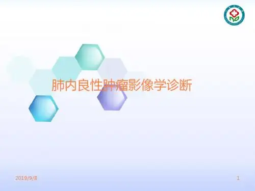 肺内良性肿瘤影像学诊断ppt课件