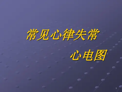 心律失常心电图表现2015