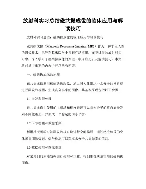 放射科实习总结磁共振成像的临床应用与解读技巧