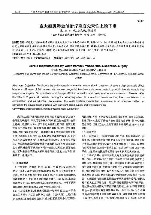 宽大额肌瓣悬吊治疗重度先天性上睑下垂