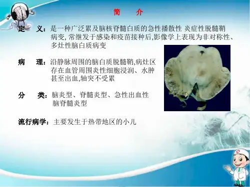ADEM急性播散性脑脊髓炎