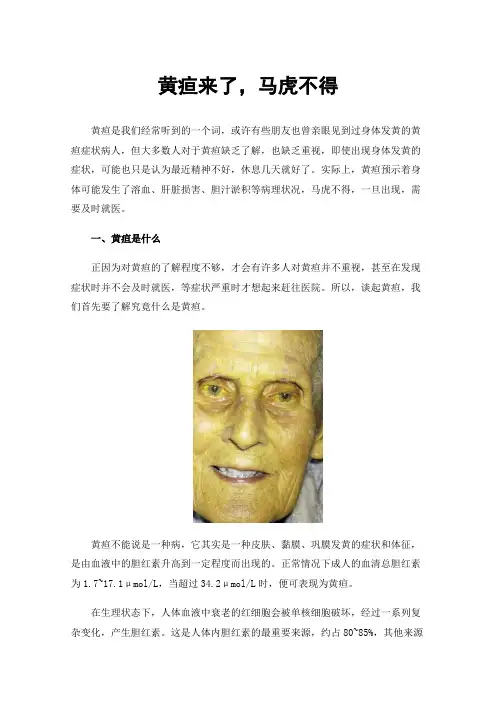 黄疸来了，马虎不得