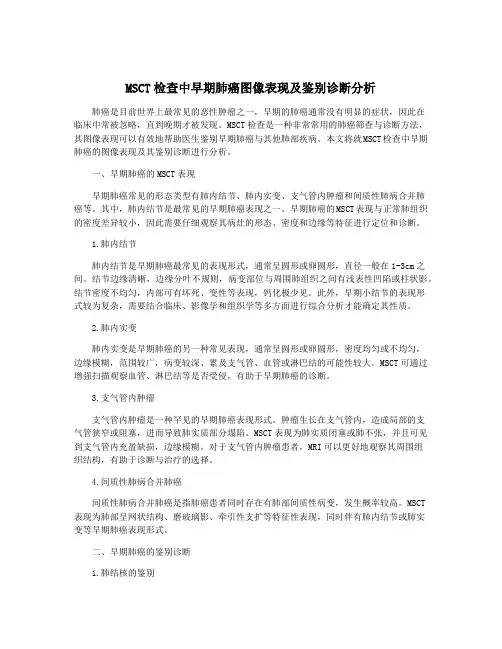 MSCT检查中早期肺癌图像表现及鉴别诊断分析