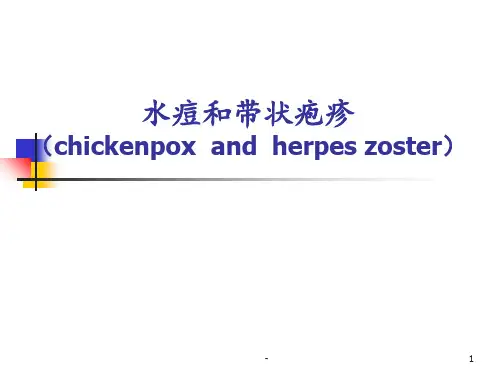 水痘本科护理PPT课件