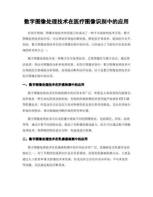 数字图像处理技术在医疗图像识别中的应用